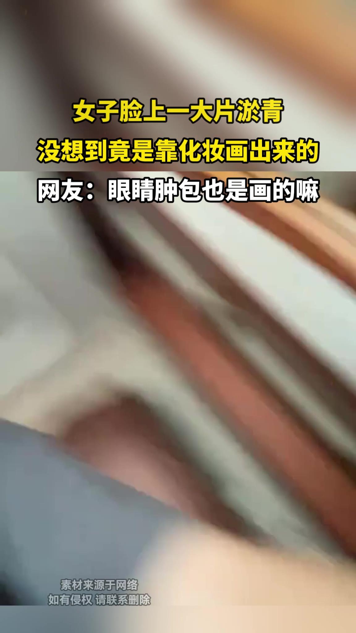 女子脸上一大片淤青,没想到竟是靠化妆画出来的!