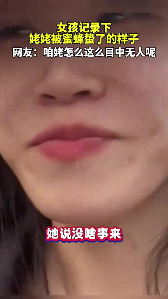 女孩记录下姥姥被蜜蜂蛰了的样子