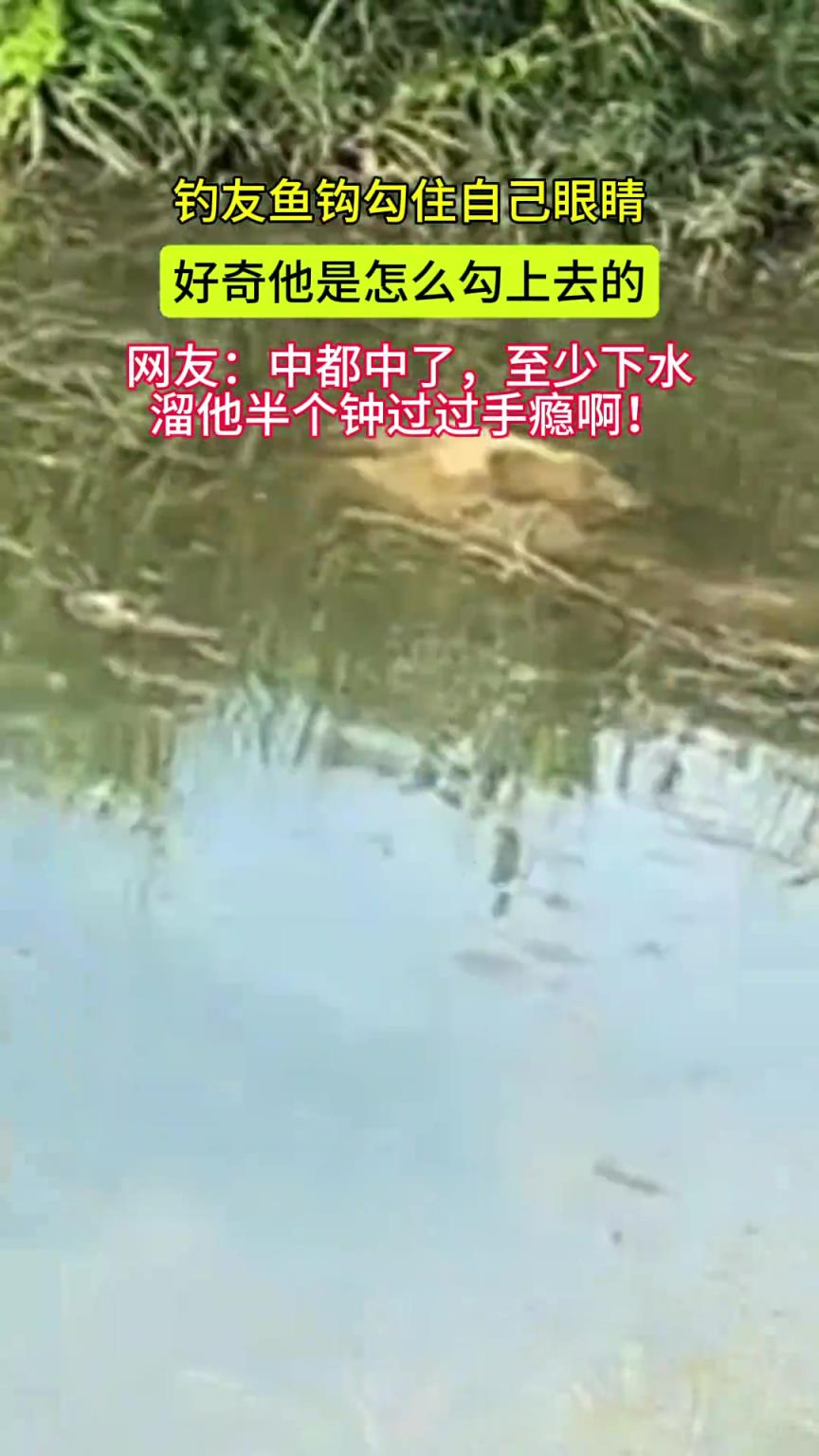 钓友鱼钩勾住自己眼睛，好奇他是怎么勾上去的