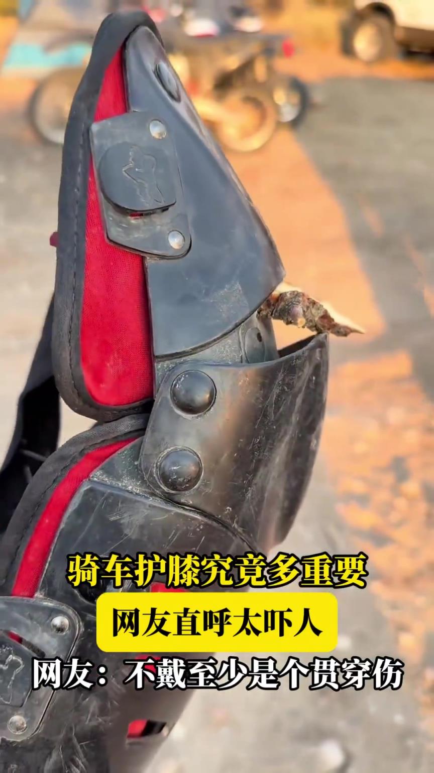骑车护膝究竟多重要，网友直呼太吓人