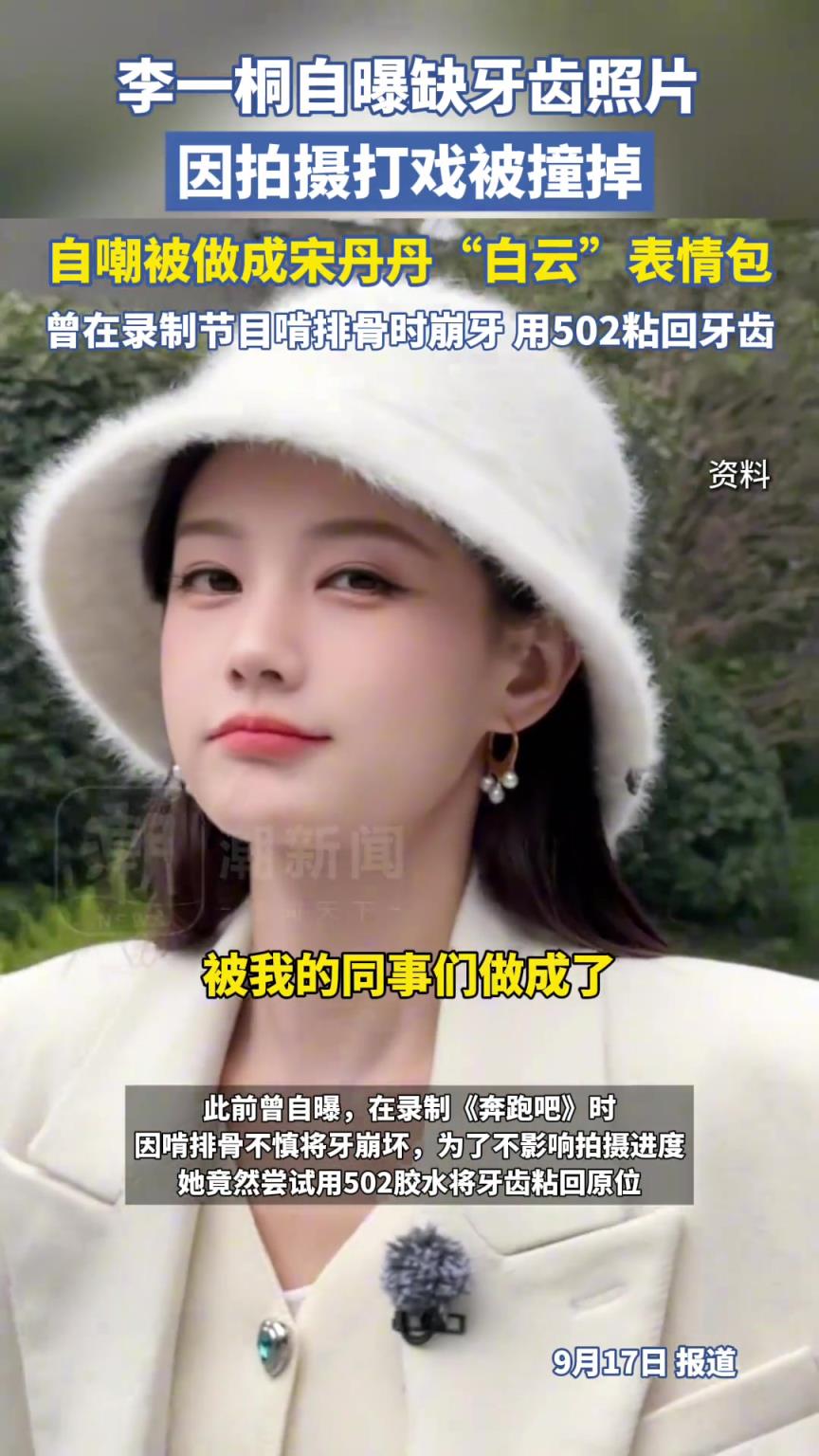 李一桐自曝缺牙齿照片，因拍摄打戏被撞掉
